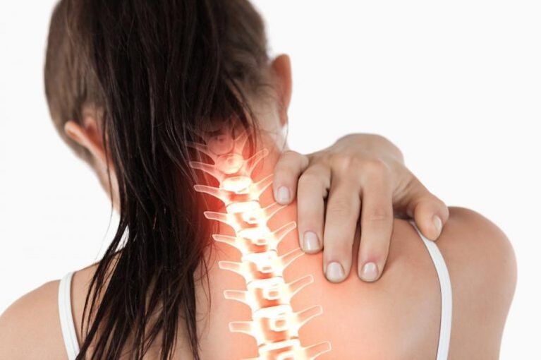 Il dolore al collo è un sintomo di osteocondrosi del rachide cervicale