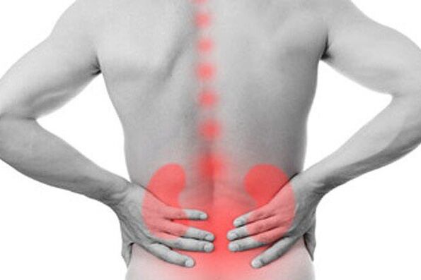 Le patologie renali possono provocare la comparsa di mal di schiena