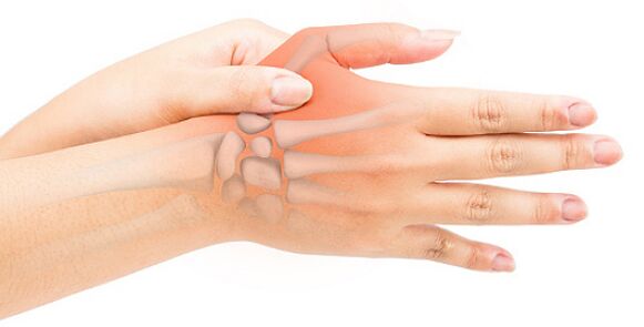 La legamentite stenosante blocca il dito in una posizione flessa
