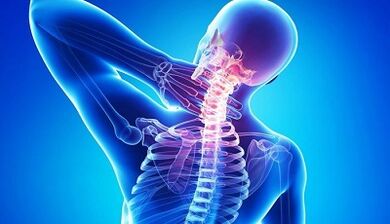 Sintomi e trattamento dell'osteocondosi cervicale