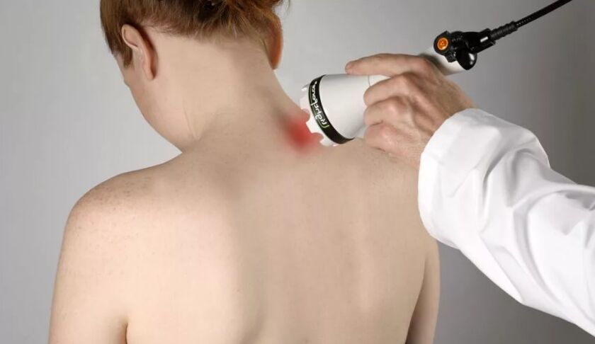 Metodo fisioterapico del trattamento dell'osteocondosi cervicale