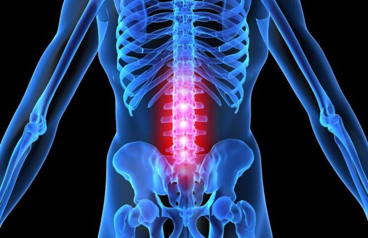 La malattia può svilupparsi a causa di molte cause